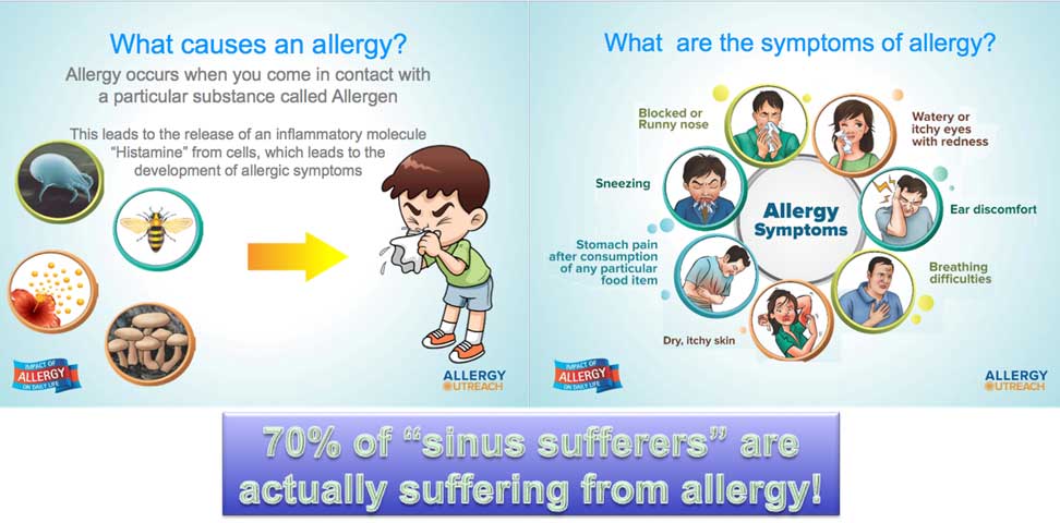 allergy